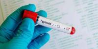 Xdr Typhoid