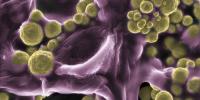 Scientists Discover Fungus Covered In Gold
