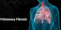 Pulmonary Fibrosis