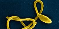 Japan Imports Ebola And Other Deadly Pathogens In Lead Up To Tokyo Olympics