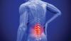 Back Bone Pain