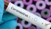 Coronavirus Test
