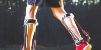 Mechanical Legs