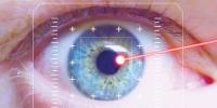 Laser Technology