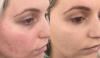 Double Tone Skin
