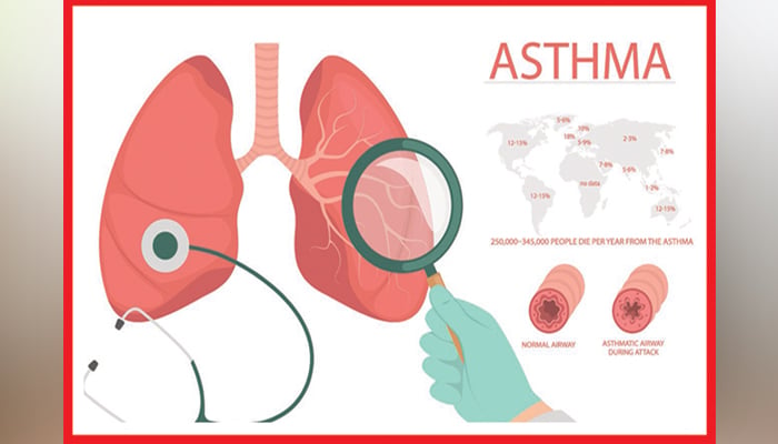 دَمہ: سانس کی نالیوں کی سوزش کا عارضہ