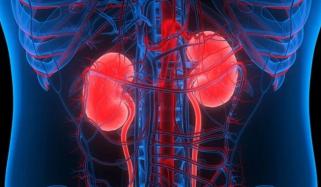 Kidney Disease