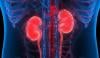 Kidney Disease