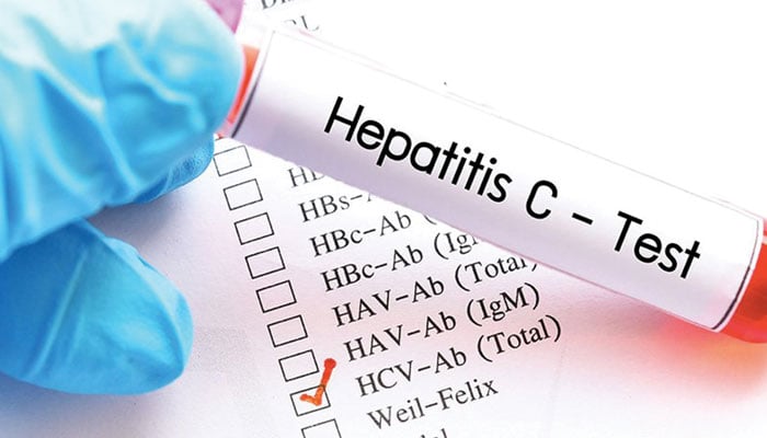 ہیپاٹائٹس سی یا کالا یرقان کیا ہے ؟