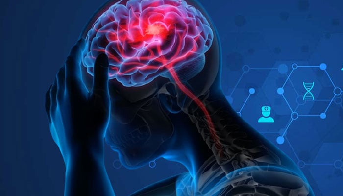 مائیگرین، ڈپریشن اور انزائٹی دماغی امراض میں اضافے کی اہم وجوہ