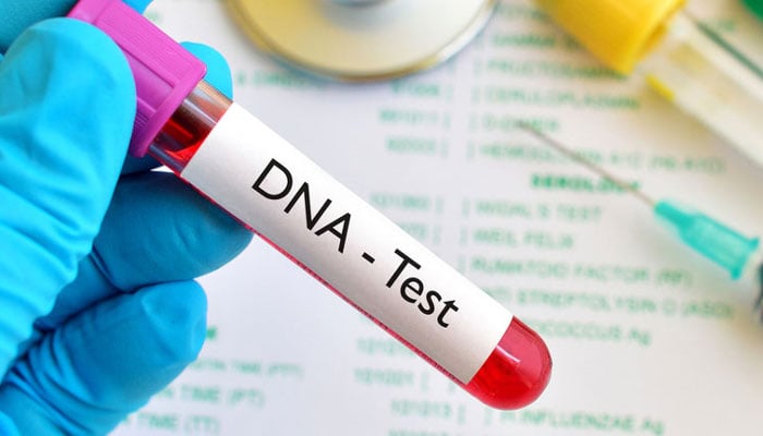 نسب، قتل اور زنا وغیرہ کے ثبوت کے لیے ڈی این اے DNA ٹیسٹ کا شرعی حکم