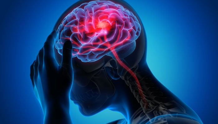 فالج اٹیک کے بعد ایک لمحہ بھی ضایع نہ کریں
