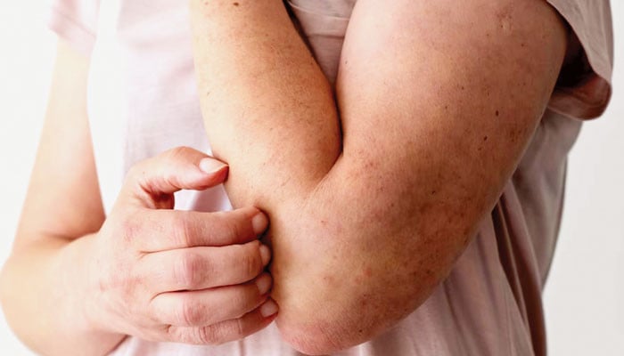 سوزش: جسم کا دفاعی ردِعمل