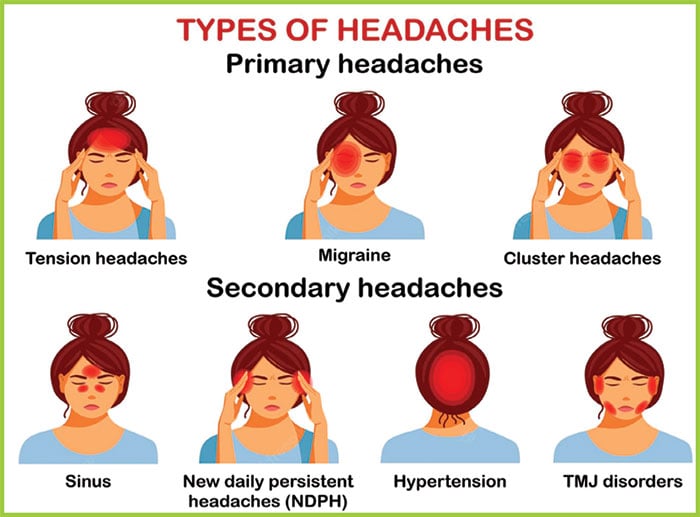 سر درد کی مختلف اقسام اور علاج کے قدرتی طریقے