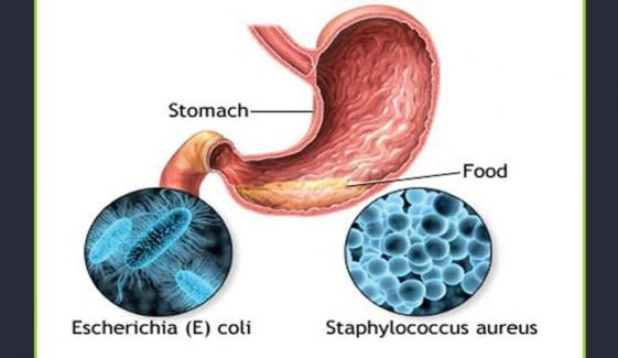فوڈ پوائزننگ ایک عام لیکن جان لیوا مرض