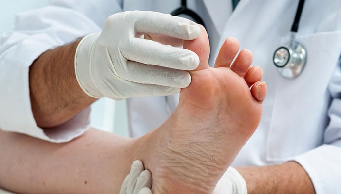 ذیابطیس اور پاؤں کی دیکھ بھال