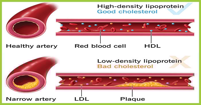 اچھا اور بُرا کولیسٹرول کیا ہے؟