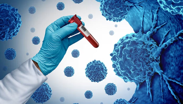 سرطان: بروقت تشخیص اور طبی جدتیں، نئی زندگی کا پیغام