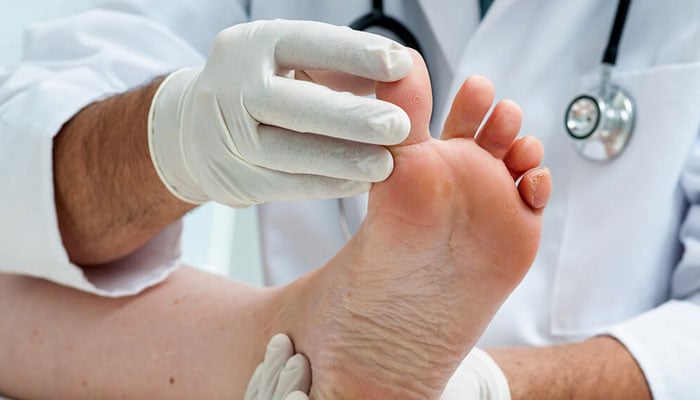 ذیابطیس اور پاؤں کے زخم
