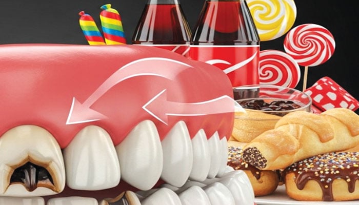 پروسیسڈ چینی کا استعمال، دانتوں کیلئے وبال