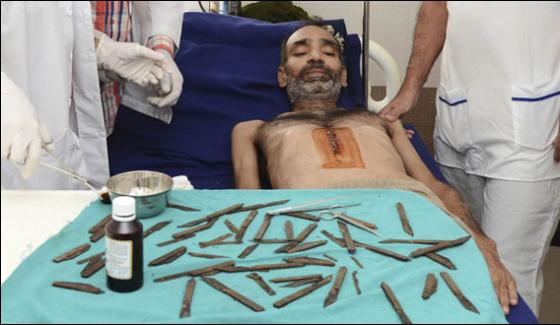 Indian Man Has 40 Knives Removed From Stomach After Urge To Eat Them