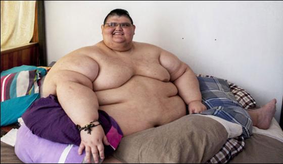 Mexico World Most Obese Man Surgery For Half Of His Weight Cut