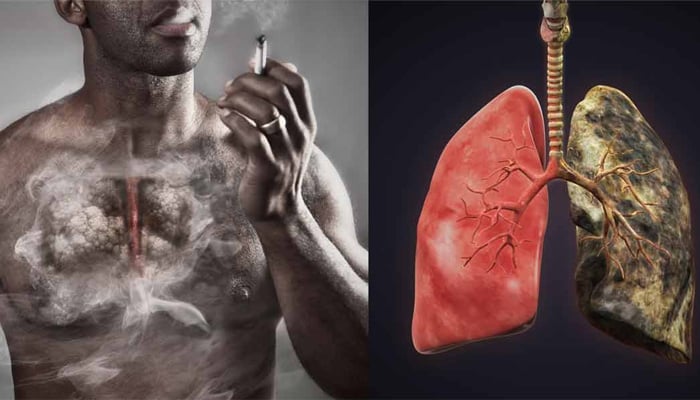 سگریٹ نوشی ، سالانہ ایک لاکھ سے زائد افراد کی موت کا اہم سبب 
