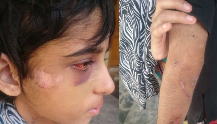 راولپنڈی میں 11 سالہ ملازمہ پر تشدد،شیریں مزاری نے نوٹس لے لیا