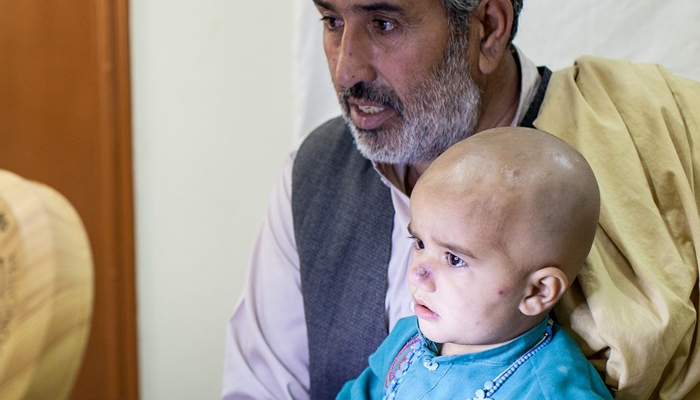 کوئٹہ میں بچے جلد کی پر اسرار بیماری کا شکار 