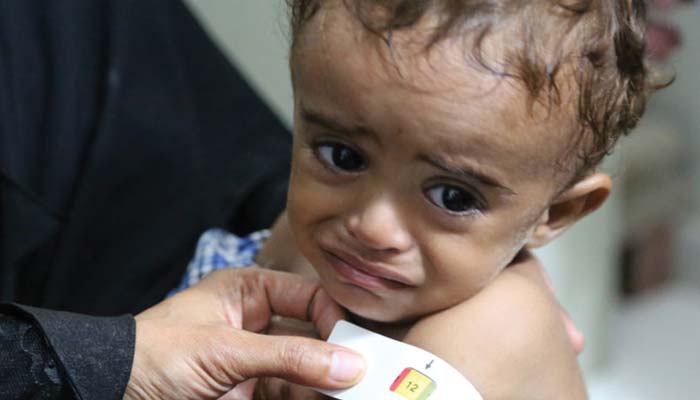 یمن:  فضائی حملوں میں 22 افراد جاں بحق