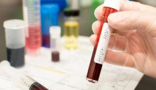 More 13 People Diagnosed With Aids In Larkana