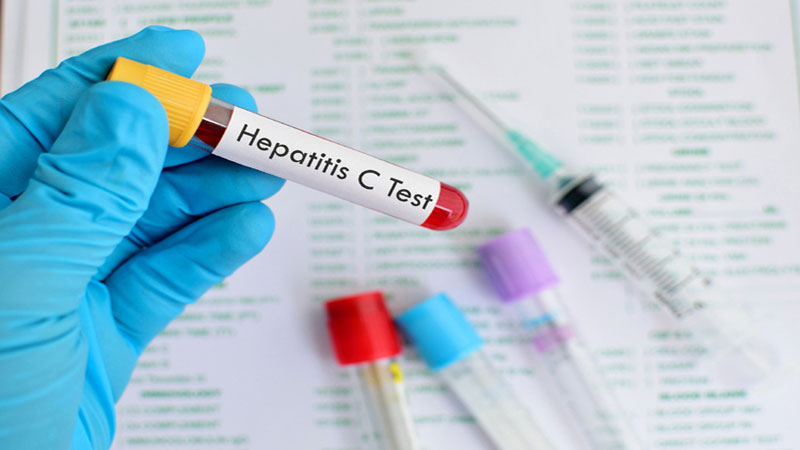 پاکستان میں ہیپاٹائٹس ای وبا کی شکل اختیار کرگیا