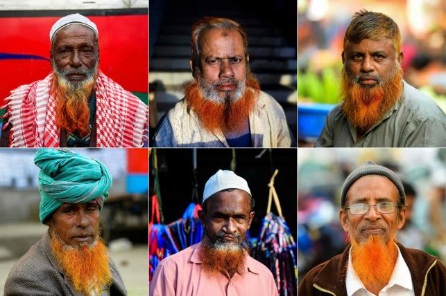 بنگلادیشیوں کے بال نارنجی رنگ کے کیوں ہوتے ہیں؟