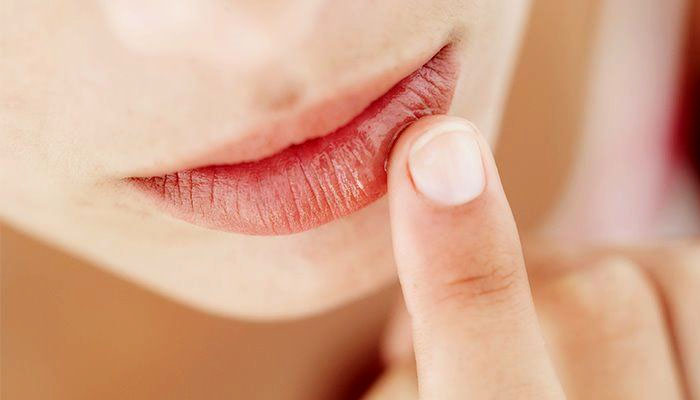 سردیوں میں ہونٹوں کو پھٹنے سے کیسے بچائیں؟