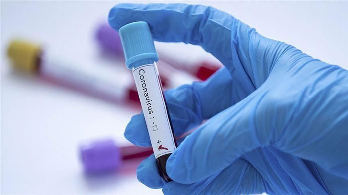 ملتان: قرنطینہ میں 546 مریضوں کا ٹیسٹ، 19 میں وائرس کی تصدیق
