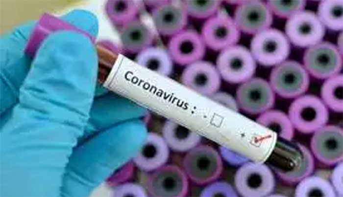 کورونا وائرس: جاپان کا پاکستان کے لیے سوا 2 لاکھ ڈالر کی امداد