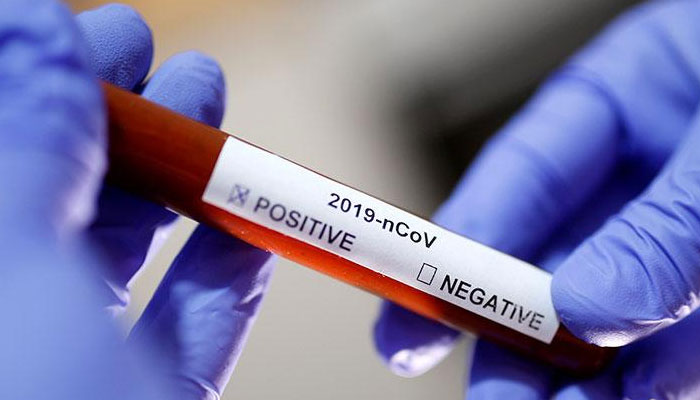 کورونا،بلوچستان میں مریضوں کی تعداد 6788 ہوگئی