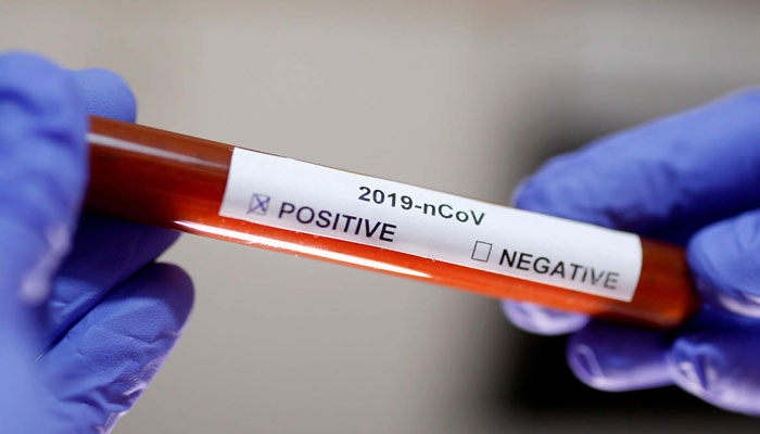 پنجاب پولیس کے 1069 افسران و اہلکار کورونا سے متاثر