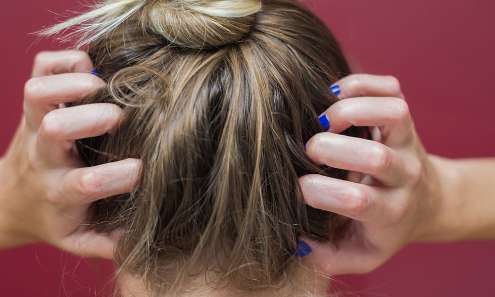  بال خراب ہونے کی وجہ سر پر زیادہ پسینہ آنا بھی ہو سکتا ہے