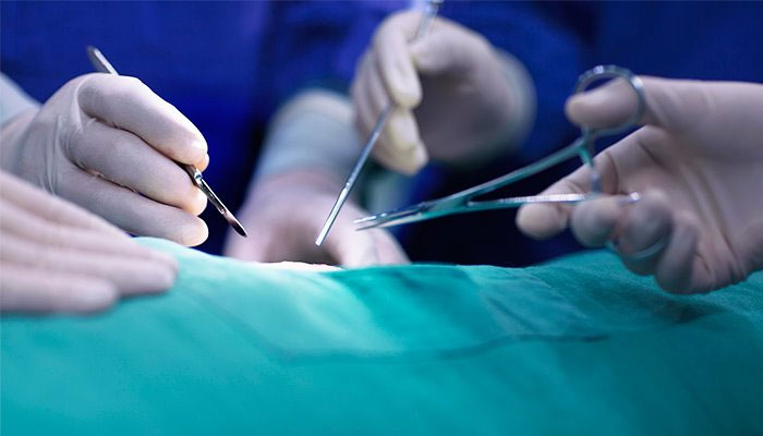 سیالکوٹ میں ڈاکٹر نے آپریشن کے دوران تولیہ مریض کے جسم میں چھوڑ دیا 