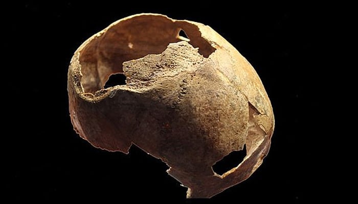  5000 سال قدیم آپریشن ہوئی کھوپڑی دریافت