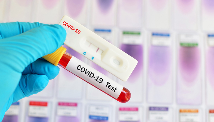 خیبرپختونخوا:کورونا وائرس کی ٹیسٹنگ پالیسی میں نیا ٹیسٹ شامل 