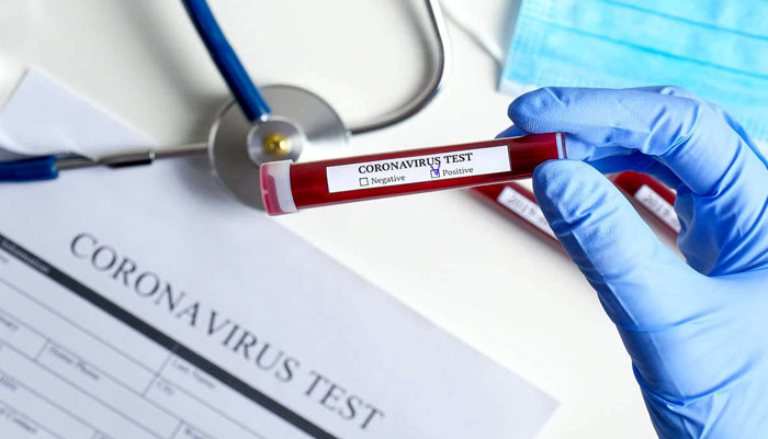 خیبرپختونخوا: کورونا وائرس نے ایک اور ڈاکٹر کی جان لے لی، تعداد 25 ہوگئی