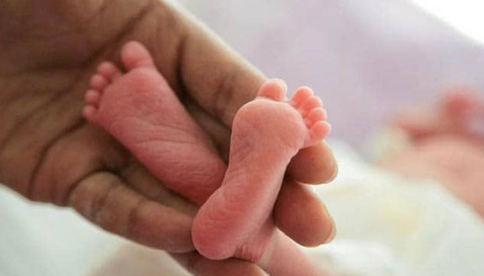 بدین: نجی اسپتال میں دو سر والے بچے کی پیدائش