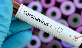 بلوچستان میں کورونا کے ہاتھوں ہلاکتوں کا سلسلہ رک نہ سکا