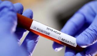 پشاور، کورونا مریض میں بھارتی وائرس کی تصدیق