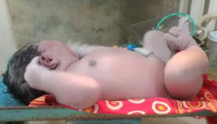 بھارتی ریاست آسام میں ریکارڈ وزنی بچے کی پیدائش