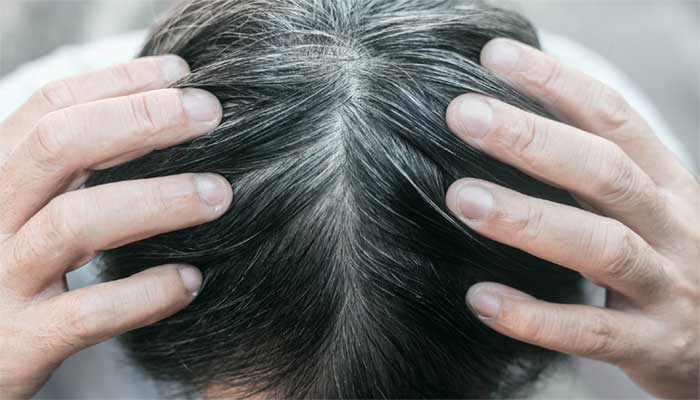 نفسیاتی اور ذہنی دباؤ کی وجہ سے بال سفید ہوجاتے ہیں، تحقیق
