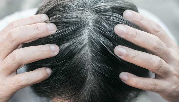 نفسیاتی اور ذہنی دباؤ کی وجہ سے بال سفید ہوجاتے ہیں، تحقیق