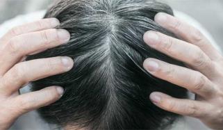 نفسیاتی اور ذہنی دباؤ کی وجہ سے بال سفید ہوجاتے ہیں، تحقیق